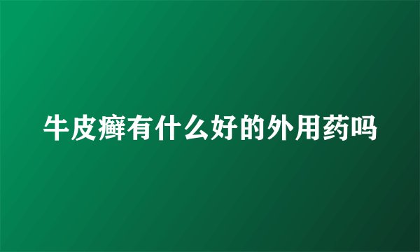 牛皮癣有什么好的外用药吗