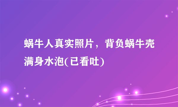 蜗牛人真实照片，背负蜗牛壳满身水泡(已看吐)